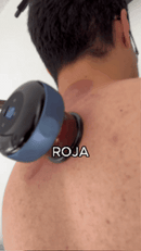 MASAJEADOR SMART TERAPIA VENTOSA Y CALOR RECARGABLE